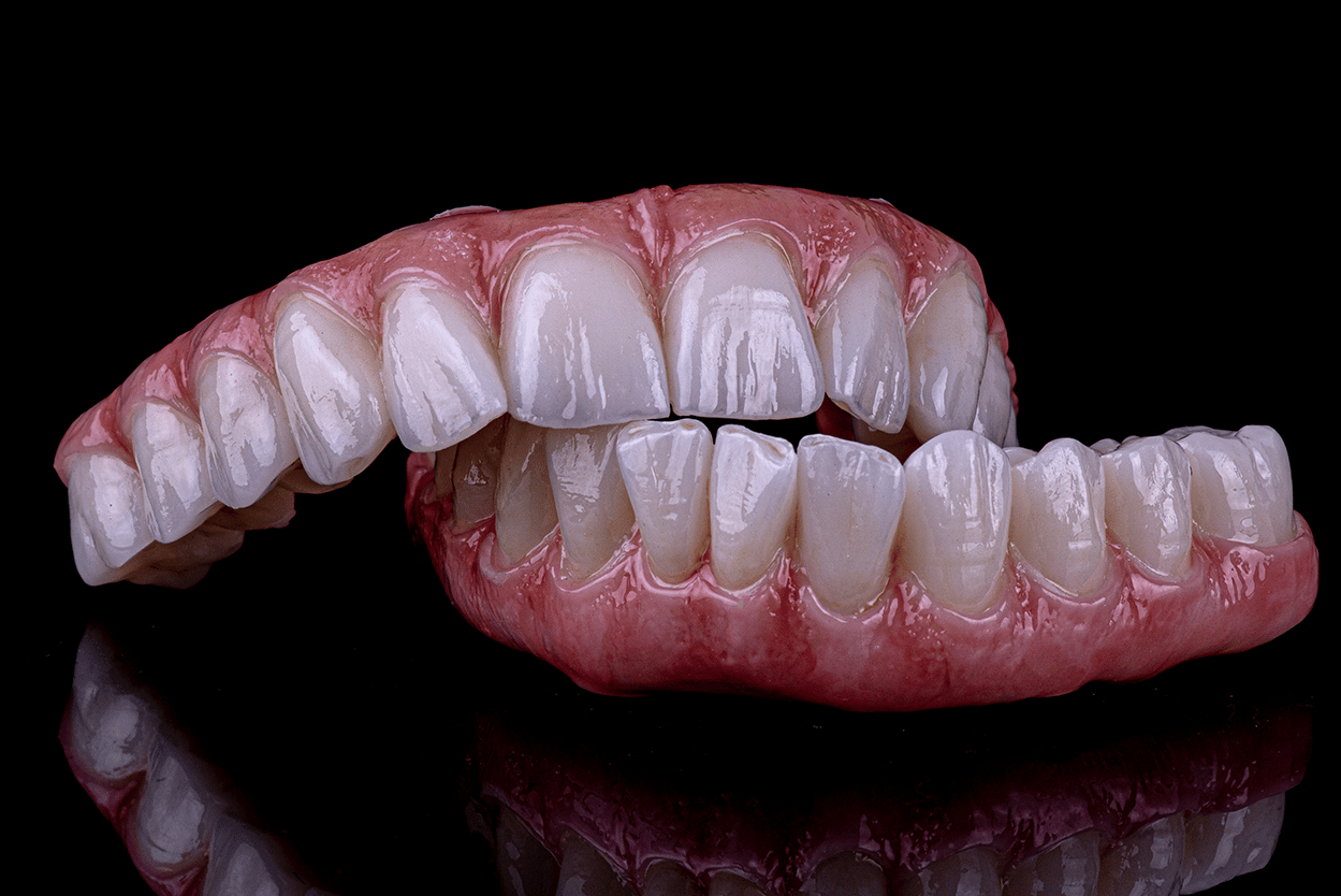 ads hybrid restorations