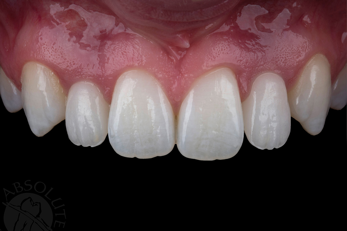 ads signature art restoration