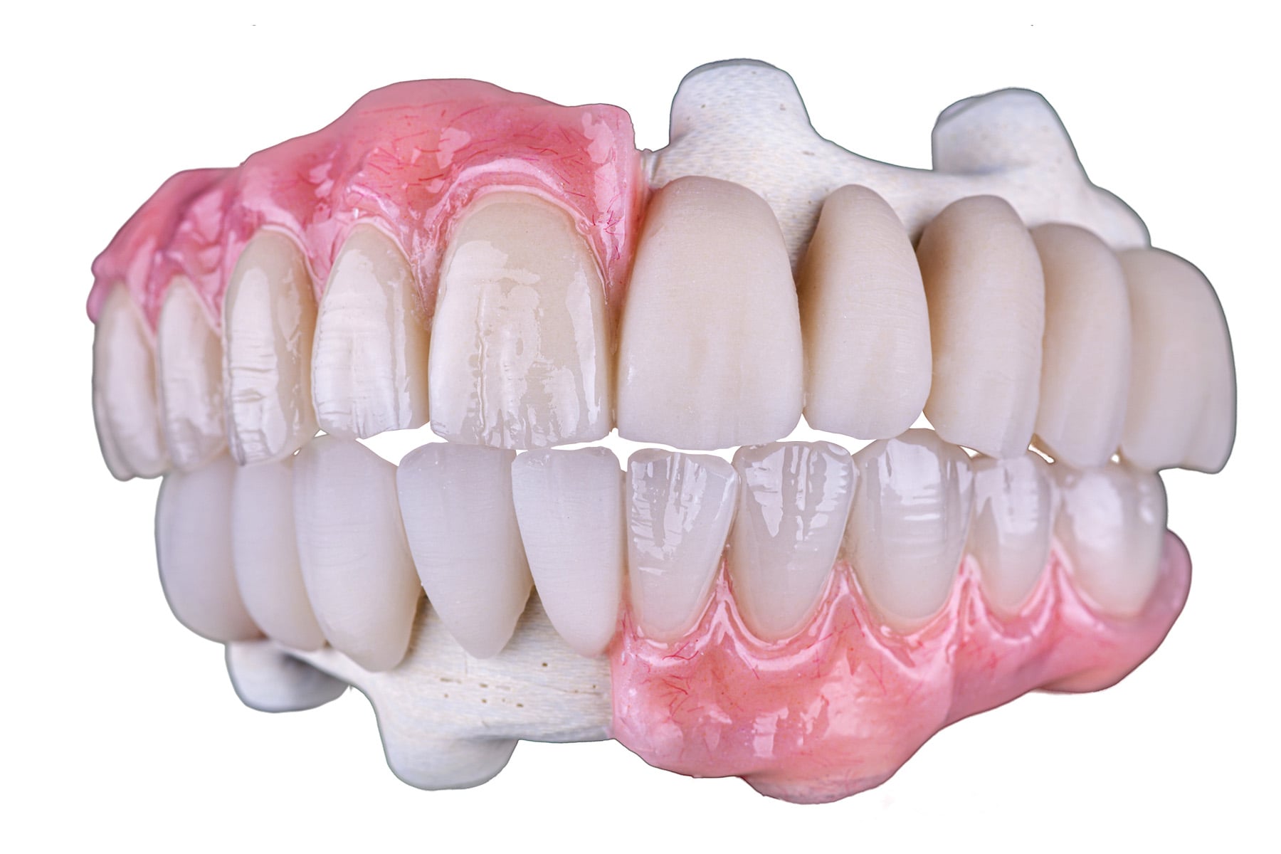 hybrid-complex-cases